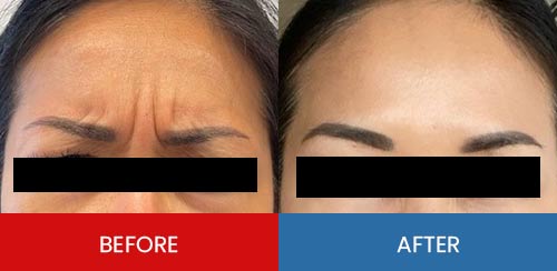 Before & After - Island Medical and Beauty Clinic in Honolulu, HI Before & After - Island Medical and Beauty Clinic in Honolulu, HI