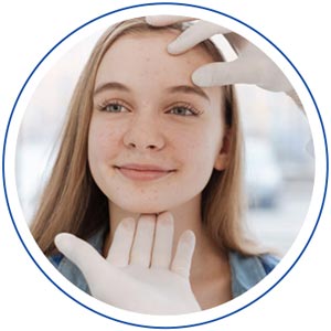 Acne (NeoClear) - Island Medical and Beauty Clinic in Honolulu, HI