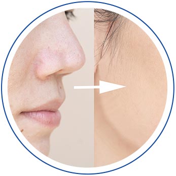 Aerolase - Island Medical and Beauty Clinic in Honolulu, HI