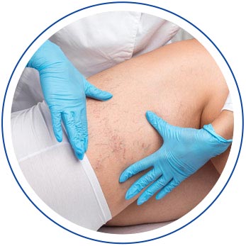 Spider Veins - Island Medical and Beauty Clinic in Honolulu, HI