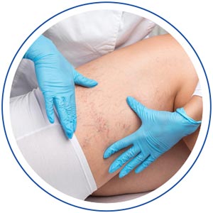 Spider Veins - Island Medical and Beauty Clinic in Honolulu, HI