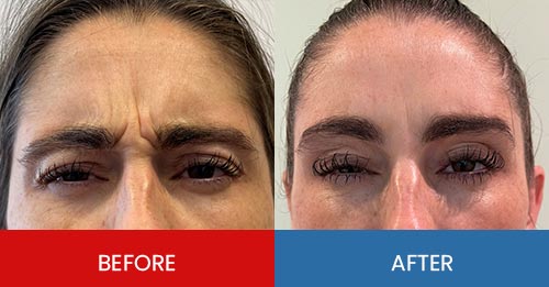 Before & After - Island Medical and Beauty Clinic in Honolulu, HI Before & After - Island Medical and Beauty Clinic in Honolulu, HI
