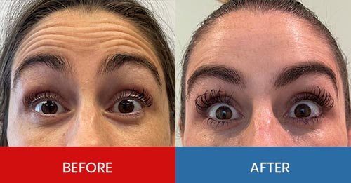 Before & After - Island Medical and Beauty Clinic in Honolulu, HI Before & After - Island Medical and Beauty Clinic in Honolulu, HI