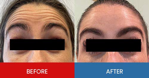 Before & After - Island Medical and Beauty Clinic in Honolulu, HI Before & After - Island Medical and Beauty Clinic in Honolulu, HI