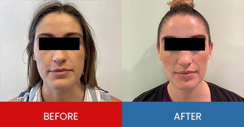 Before & After - Island Medical and Beauty Clinic in Honolulu, HI