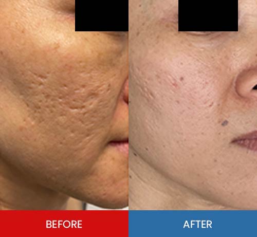 Before & After - Island Medical and Beauty Clinic in Honolulu, HI Before & After - Island Medical and Beauty Clinic in Honolulu, HI