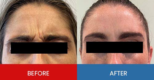Before & After - Island Medical and Beauty Clinic in Honolulu, HI Before & After - Island Medical and Beauty Clinic in Honolulu, HI